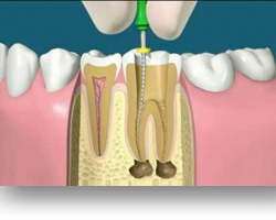 Periodoncia