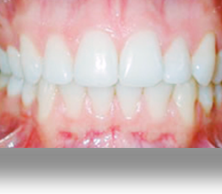 Periodoncia